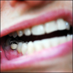 зуб после пломбировки каналов